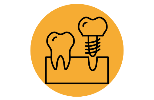 Implants & Dentures