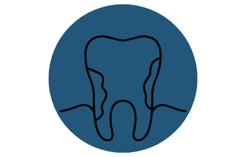 Periodontal Treatment